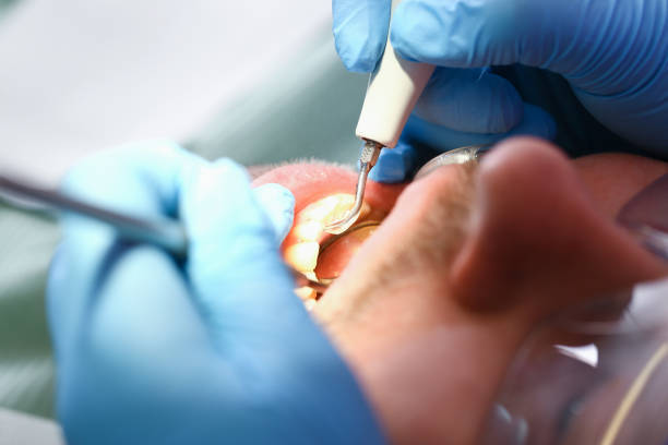 Best Urgent Tooth Repair  in Mount Ida, AR
